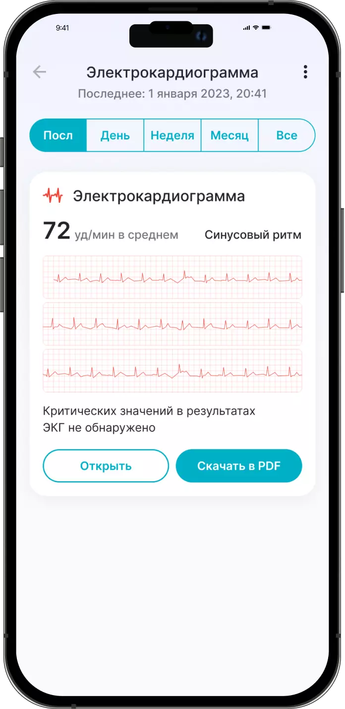 Электрокардиограмма онлайн